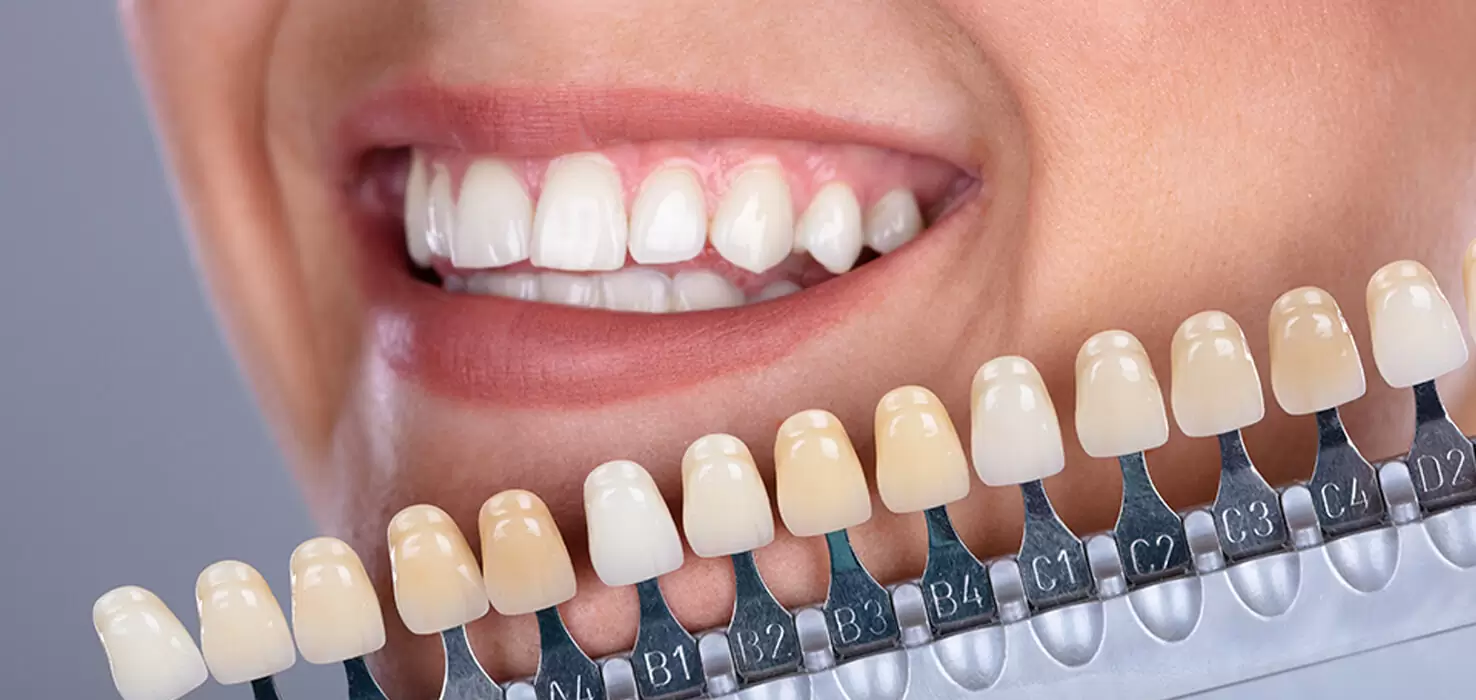  Estetik Diş Hekimliği