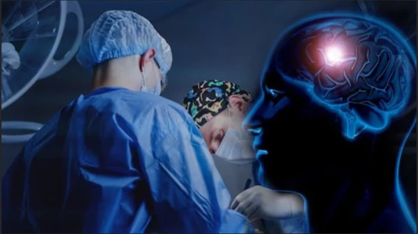 Endeskopik Beyin Ameliyatları